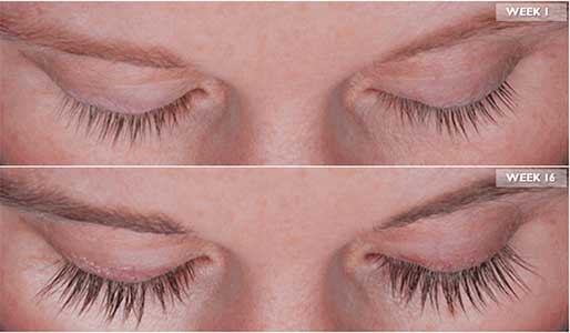 Los Angeles Eyelash Treatment