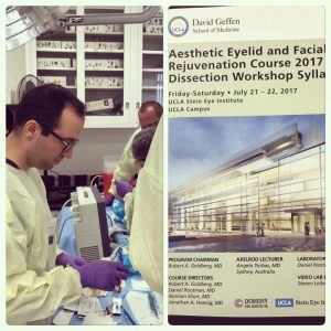 Los Angeles Aesthetic Eyelid and Facial Rejuvenation Course 2017 Dissection Workshop Dr. Taban