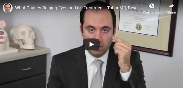 What Causes Bulging Eyes and it's Treatment - TabanMD, Beverly Hills, Los Angeles, Santa Barbara
