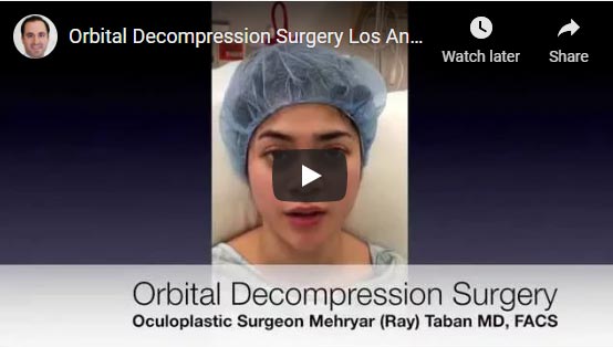 Orbital Decompression Surgery Los Angeles, Beverly Hills