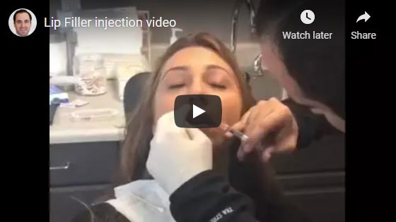 Surgical video demonstrating scarless orbital decompression.