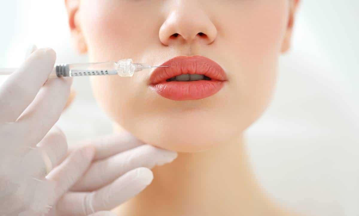 Woman getting dermal fillers which are not considered plastic surgery.