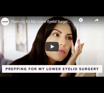 Planning for My Lower Eyelid Surgery | In the OR (Part 1 of 3)