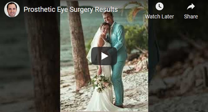 Prosthetic Eye Surgery Results