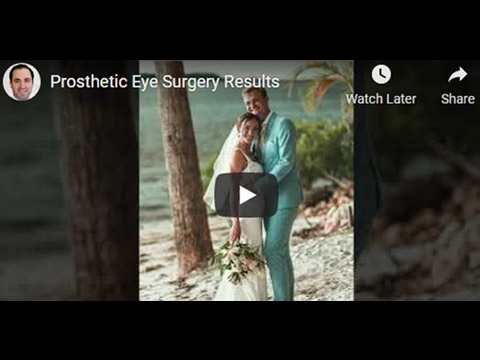 Prosthetic Eye Surgery Results click to see video