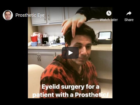Prosthetic Eye click to see video