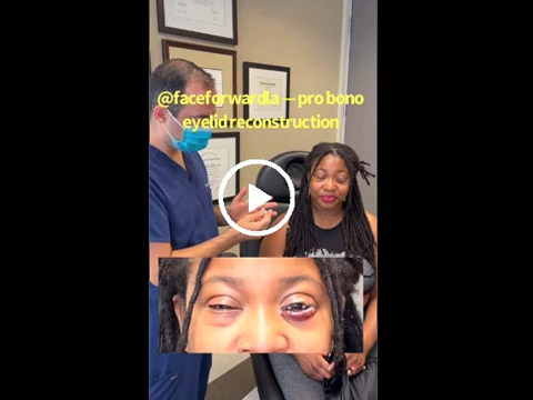 Eyelid Reconstruction Pro Bono by Dr. Taban click to see video