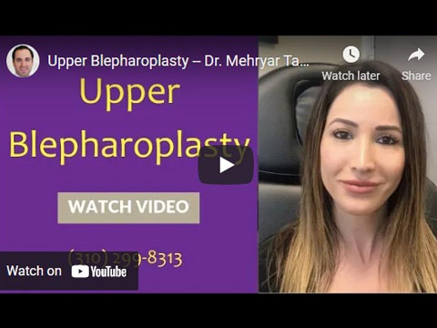 Upper Blepharoplasty -- Dr. Mehryar Taban click to see video