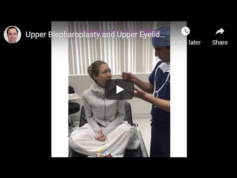 Upper Blepharoplasty and Upper Eyelid Filler-- Dr. Mehryar Taban click to see video