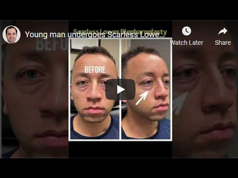 Young man undergoes Scarless Lower Blepharoplasty click to see video