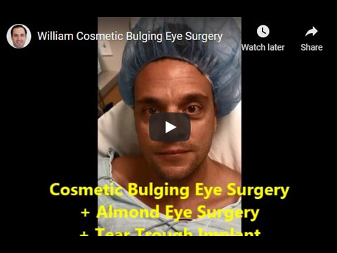 William Cosmetic Bulging Eye Surgery click to see video