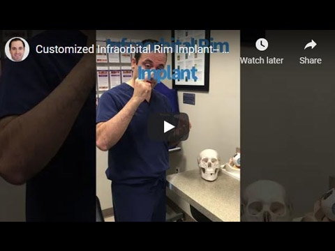 Customized Infraorbital Rim Implant click to see video