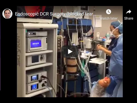 Endoscopic DCR Surgery (blocked tear duct surgery) by Dr. Taban click to see video