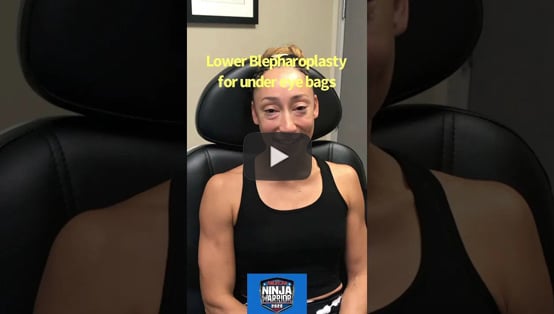 Athlete from Ninja Warrior TV underwent scarless lower blepharoplasty click to see video