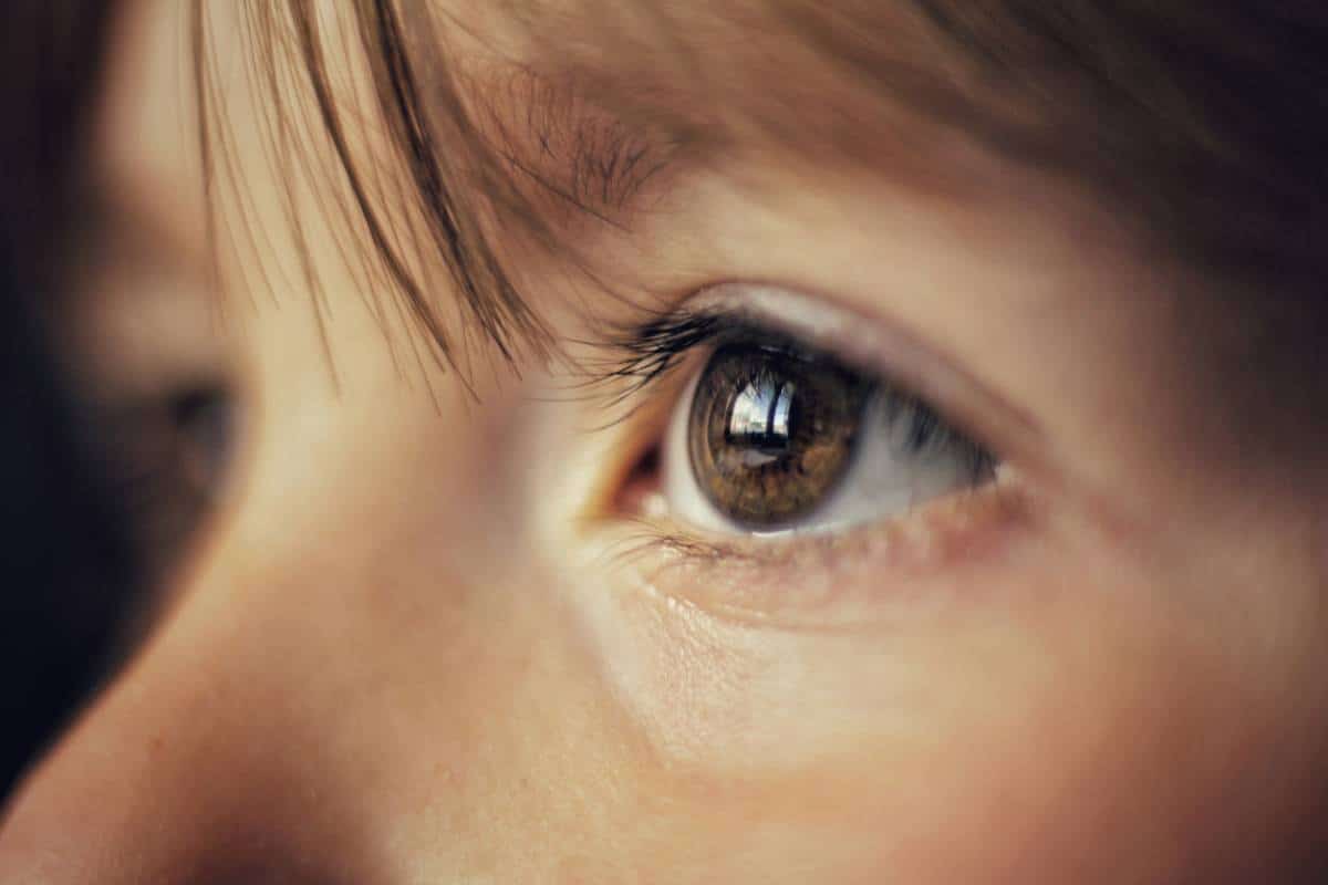 featured image for 3 most common oculofacial issues in children